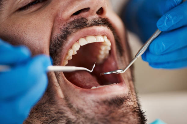 Dental X-Rays and Imaging in Winfield, WV
